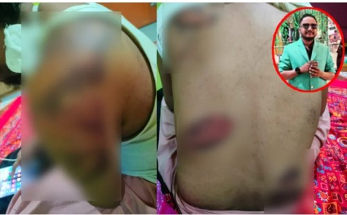 কোম্পানীগঞ্জে প্রকাশ্যে ঘুরে বেড়াচ্ছে প্রবাসীর ওপর হামলা মামলার আসামিরা 