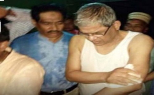 চট্টগ্রামে মির্জা ফখরুলের উপর হামলার ঘটনায় হাছান মাহমুদসহ ৮৬ জনের বিরুদ্ধে মামলা 